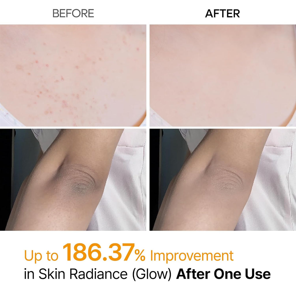 Dr. Melaxin Peel Shot Kojic Acid & Turmeric Body Spray – 200mL