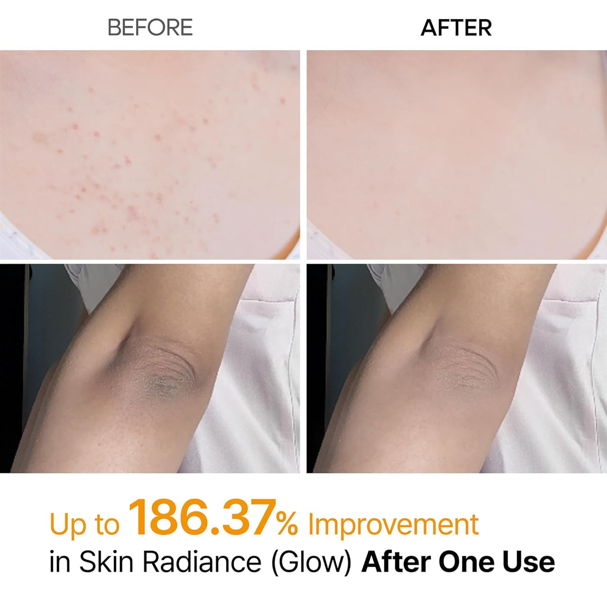 Dr. Melaxin Peel Shot Kojic Acid & Turmeric Body Spray – 200mL